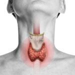 Thyroid